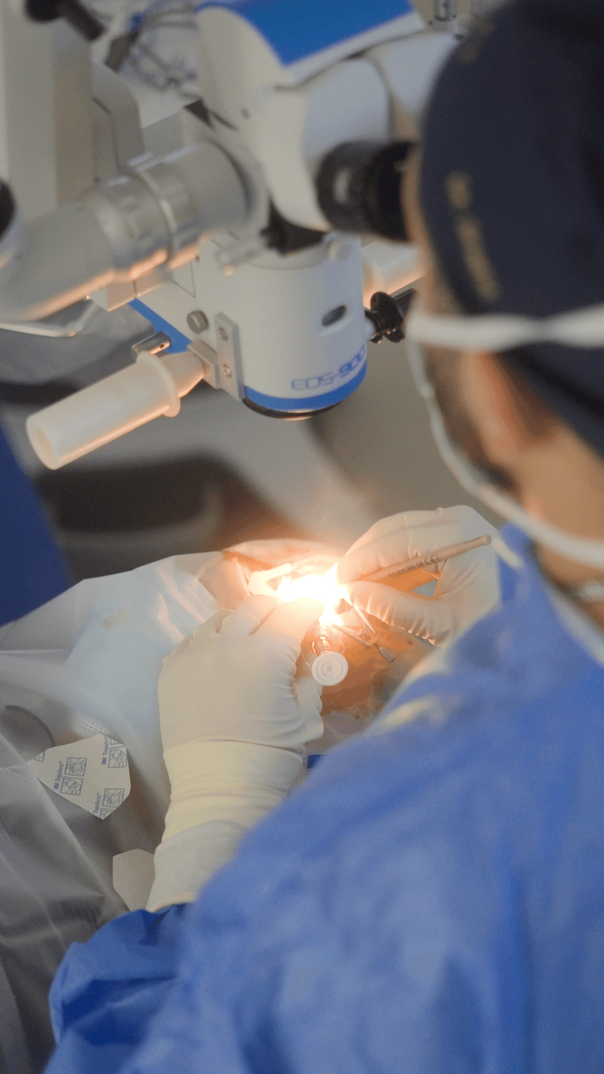 Surgery step in the Visionary Eye consultation and surgery process